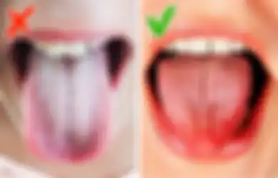 Menjaga Kebersihan Lidah Penting, Tapi Bukan dengan Disikat, Bisa-bisa Malah Hal Ini yang Terjadi