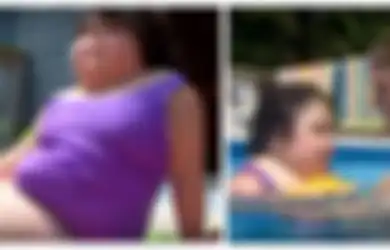 5 Kisah para 'Putri Duyung' di Dunia Nyata, Selalu Divonis Tak Akan Berumur Panjang oleh Medis
