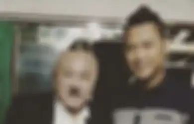 Wajah Komedian Ini Bengkak Hingga Pingsan Sebelum Meninggal Karena Sakit Jantung, Makanan Lezat dan Gurih Ini  Bisa Jadi Penyebabnya