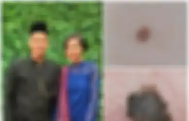 Waahh… Ternyata yang Sering Digunakan Memasak Ini Bisa Jadi Penyebab Kanker Kulit yang Renggut Nyawa Menantu Hatta Rajasa, Hati-hati!
