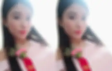 Nasib Malang! Perempuan Ini Telan Pil Pahit, Kakinya Diamputasi Usai Jadi Pengiring Pengantin