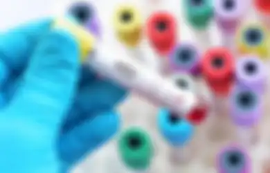 3 Siswa SD yang Tertular HIV Mau Diusir, Ini Alasan Remaja Rentan Terkena HIV