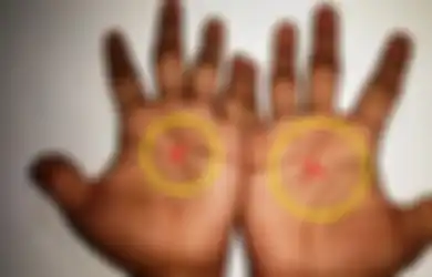 Jika Temukan Tanda X ini Pada Telapak Tanganmu, Tunjukkan Jika Kamu Orang yang Seperti ini
