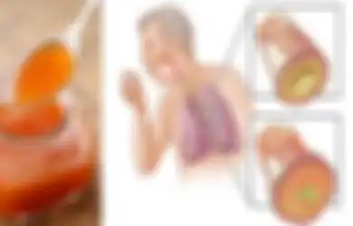 Minum Sirup Wortel 3 Sendok Setiap Hari Saat Kondisi Ini, Beberapa Hari Kemudian Anda Akan Merasakan Manfaatnya!