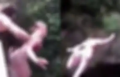 Masih Ingat Gadis yang Didorong Temannya dari Atas Jembatan? Begini Kabar Terbarunya