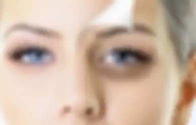 Kandungan Skincare Terbaik Biar Mata Panda Hilang dalam Sekejap!