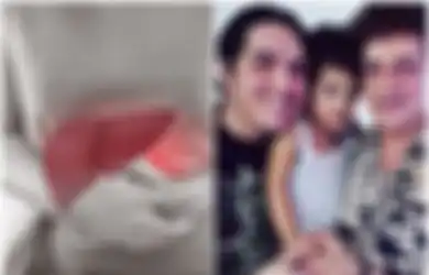Putra Ahmad Hembuskan Napas Terakhir Akibat Sakit Liver yang Menggerogoti Tubuhnya, Ternyata 3 Makanan Favorit Banyak Orang Ini Disinyalir Jadi Penyebab Utama!
