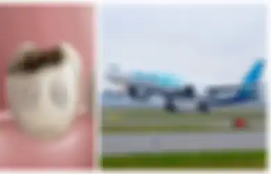 Jangan Pernah Naik Pesawat Terbang Jika Punya Gigi Berlubang , Ini Alasannya!