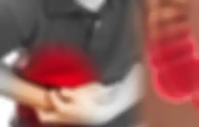 Jangan Diabaikan Karena Dapat Mengancam Jiwa, Ini Gejala Usus Buntu Kronis, Apa Bedanya dengan Usus Buntu Akut?