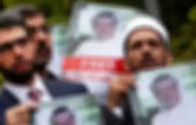 Jamal Khashoggi Dilenyapkan dengan Zat Asam Setelah Dimutilasi, Ini Dampak Mengerikan Zat Tersebut pada Tubuh Manusia