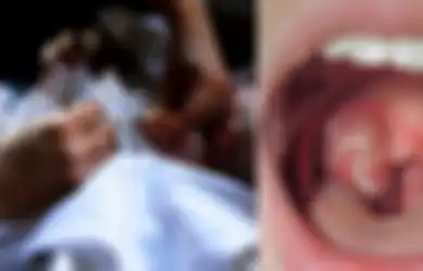 Orangtua Tolak Beri Imunisasi Difteri, Bayi 14 Bulan Meninggal Dunia, Miris