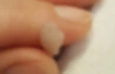 'Saya Sangat Marah,' Kata Ibu yang Janinnya Dinyatakan Tak Bernyawa Dibuang & Disebut Limbah Medis, Ibu 11 Anak Ini Juga Lakukan Hal di Luar Nalar