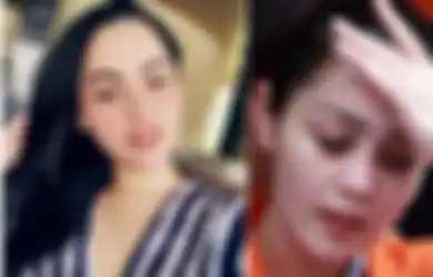 Hidup di Bali Bersama Jennifer Dunn, Tubuh Faisal Harris yang Makin Kurus Jadi Sorotan, Ada Apa? 