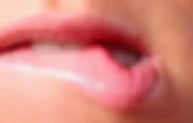 Waspada dengan Bercak Putih dan Luka yang Tak Kunjung Sembuh di Bibir, Jadi Pertanda Kanker Mulut