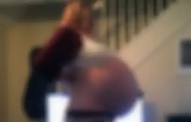 Sempat Dikira Hamil, Perut Wanita Ini Ternyata Membesar karena 'Mengandung' Kista Seberat 26 Kg