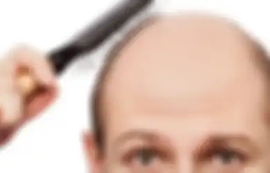 Merasa Tidak Percaya Diri Karena Rambut Tipis Lalu Gunakan Penumbuh Rambut, Ingat! Ini Bisa Bikin Pria Alami Impotensi di Usia Muda, Berhati-hatilah!