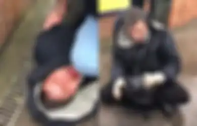Terciduk: Pria yang Diduga Pedofil Melakukan Aksi Brutal dengan Menggigit Jari Pemburu Pedofil ketika Dikepung!