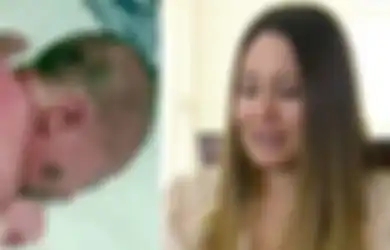 Bayi Ini Lahir dengan Tubuh Dipenuhi Tahi Lalat, Ibunya Menangis Takut Anaknya Di-bully Ketika Dewasa Nanti