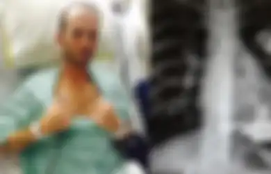 Kisah Seorang Petualang yang Harus Hidup Tanpa Jantung karena Tak Kunjung Mendapat Donor, Ini 'Penyelamatnya'