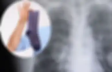 Pria Kena Infeksi Paru-paru Karena Sering Mengendus Kaus Kaki, Mungkinkah Kita Berisiko Terinfeksi Jika Melakukan Hal yang Sama?