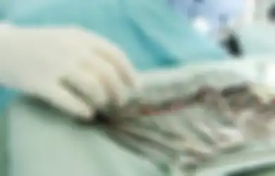 5 Transplantasi Organ Paling Menarik, Ada Transplantasi Mr. P hingga Wajah
