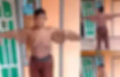 Mengenal Operasi Bariatrik yang Bantu Arya Turunkan Berat Badan Hingga 100 Kg