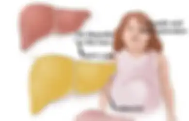 Penyakit Perlemakan Hati? Obati dengan Buah-buahan Terbaik Berikut
