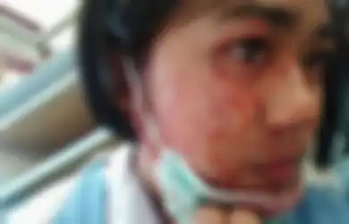 4 Kasus Kondisi Langka pada Manusia, Salah Satunya Wanita yang 'Nangis Darah’