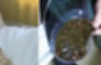 Tak Pernah Sarapan dan Jarang Minum Air Putih, Wanita Tiongkok Ini Temukan 2000 Batu Empedu di Tubuhnya!