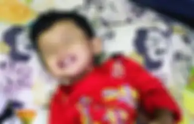 Digigit Serangga, Kaki Anak Ini Terinfeksi Bakteri Pemakan Daging dan Terancam Diamputasi