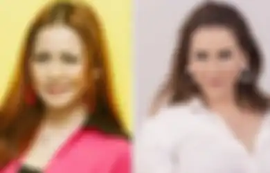 Niat Hati Permak Wajah hingga Rogoh Kocek Rp 1 M Demi Operasi Plastik, Penyanyi Dangdut Seksi Ini Justru Alami Kelumpuhan, Terkuak Kondisinya Kini!
