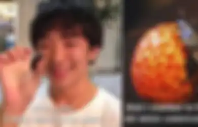 Jatuh Cinta pada Kecoa, Koki Asal Jepang Pacari Si Serangga Selama Hidupnya Hingga Anggap Wanita Tak Menarik Lagi