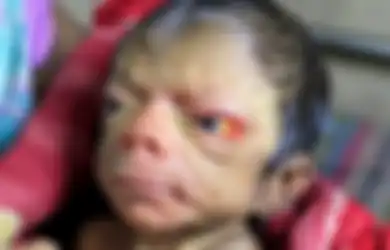 Miliki Wajah Tak Lazim, Dokter Syok Setelah Bayi Laki-laki Ini Lahir, Reaksi Kedua Orang Tuanya di Luar Dugaan hingga Terungkap Fakta Ini