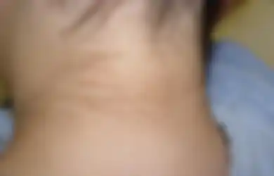 Nggak Perlu Rogoh Kocek Dalam-dalam, Begini Cara Alami Mencerahkan Leher yang Menghitam, Semua Bahannya Ada di Dapur