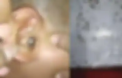 Video Bocah Menangis Karena Telinganya Kemasukan Semut: Ini yang Harus Kita Lakukan Jika Telinga Kemasukan Semut