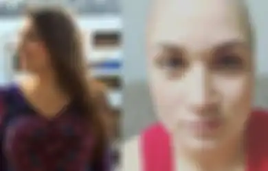 Sakit Perut Selama 9 Tahun, Wanita Ini Baru Tahu Ternyata Ia Menderita Kanker Ovarium