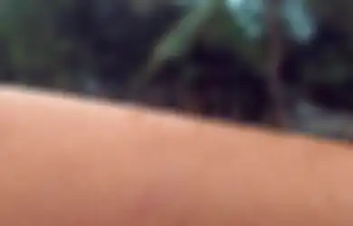 Ini Arti Kesehatan Dibalik Lebatnya Bulu di Setiap Bagian Tubuh Wanita