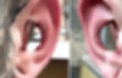 Conch Removal, Tren 'Melubangi' Bagian Tengah Telinga, Berani Coba?