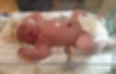 Lahirkan Bayi Seberat Hampir 7 Kilogram, Sang Ibu Ceritakan Proses Melahirkan: Saya Merasa Seperti Dihantam Dua Truk Trailer