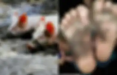 Ngeri! Kaki Bocah 10 Tahun Membusuk dan Bernanah Usai Bermain dan Lakukan Kegiatan Ini Tanpa Alas Kaki