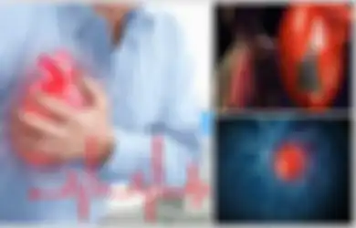 Peduli Tubuhmu: Mengenali Serangan Jantung, Ini Gejalanya dan Siapa yang Berisiko Terkena Serangan Jantung