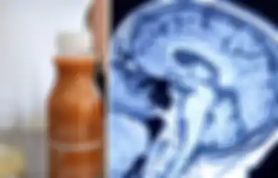 Horor! Niat Hati Ingin Kurus dengan Minum Jus Pelangsing, Perempuan Ini Malah Alami Kerusakan Otak