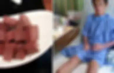 Akibat Makan Darah Babi, Pria Ini Menderita Infeksi Mematikan dan Kedua Kakinya Diamputasi