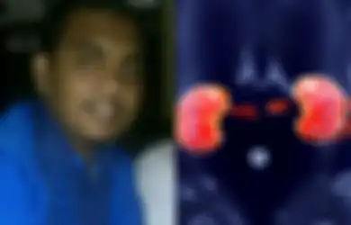 Kisah Pemilu 2014: Caleg Gagal Ingin Jual Ginjal Demi Bayar Utang Kampanye Rp420 juta