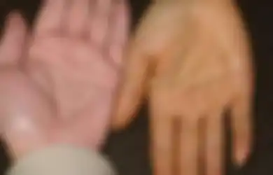 Perhatikan Tangan Anda, Jika Berubah Menjadi Kuning Setelah Makan Wortel Inilah yang Terjadi Pada Tubuh Anda
