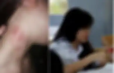Curiga Lihat 'Cupang' di Leher Putrinya, Setelah Diinterogasi Sang Putri Akhirnya Mengaku Telah Melakukan Hal Ini dengan 5 Pria