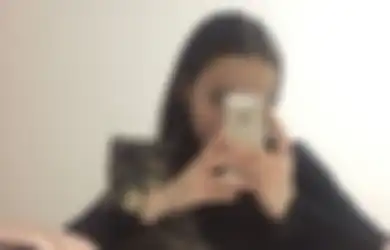 Tengkoraknya Retak Usai Jatuh dari Ketinggian 30 Meter Saat Ingin Selfie, Ajaibnya Gadis 15 Tahun Ini Selamat