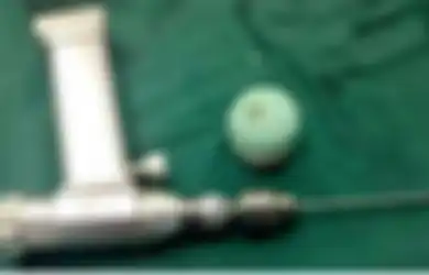 Berniat Atasi Sembelit, Pria Ini Masukan Benda Ini ke Dalam Anus, Namun Nyawanya Justru Terancam