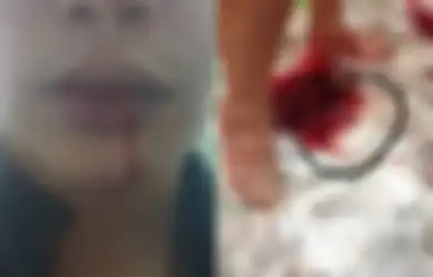 Tak Diberi Uang, Suami Pengangguran Serang Istrinya yang Hamil Sampai Pendarahan Hingga Janinnya Keluar