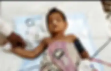 Seperti Keajaiban, Bocah 3 Tahun Ini Bertahan Hidup Setelah Tubuhnya Tertusuk Tongkat Besi dan Jatuh dari Ketinggian 9 Meter